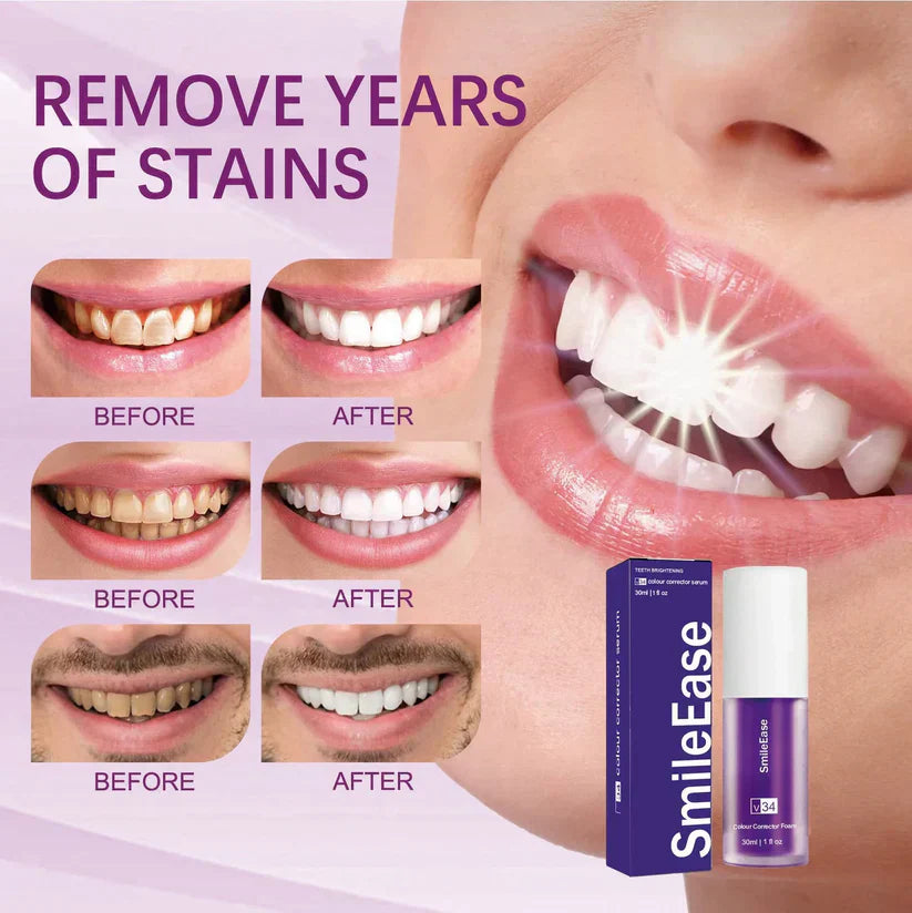 HiSmile V34 Teeth Whitening Serum