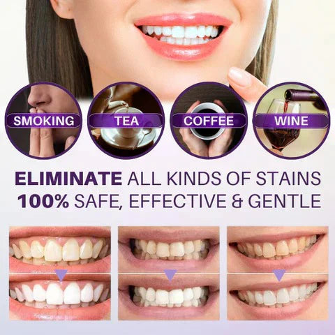 HiSmile V34 Teeth Whitening Serum