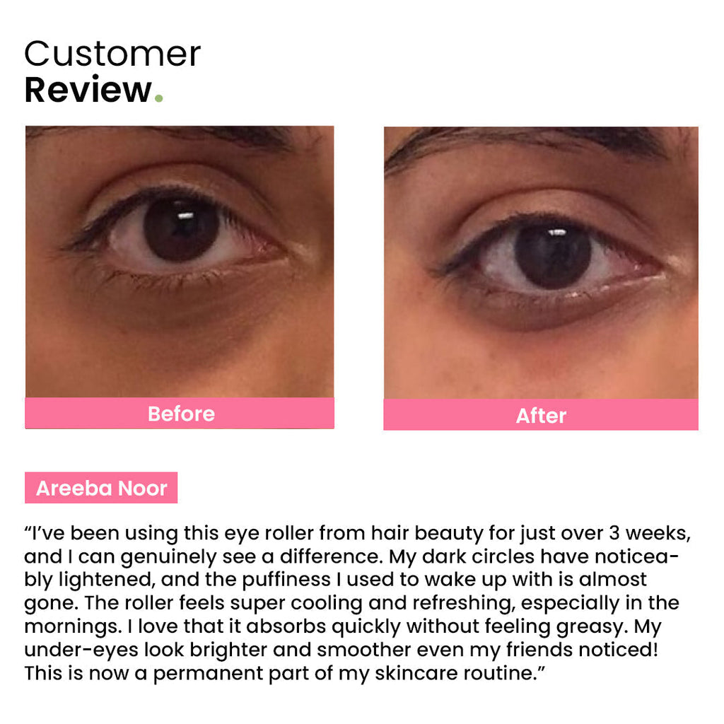 Eye Roller | Eliminates Dark Circles & Puffy Eyes